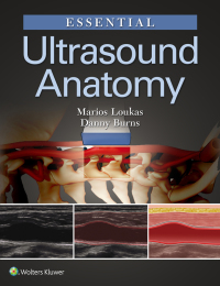 表紙画像: Essential Ultrasound Anatomy 9781496383532