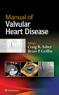 Imagen de portada: Manual of Valvular Heart Disease 9781496310125