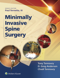 表紙画像: Minimally Invasive Spine Surgery 9781496301321