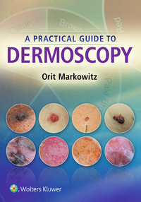 Titelbild: A Practical Guide to Dermoscopy 7th edition 9781451192636