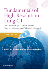 Cover image: Fundamentals of High-Resolution Lung CT 2nd edition 9781496389923