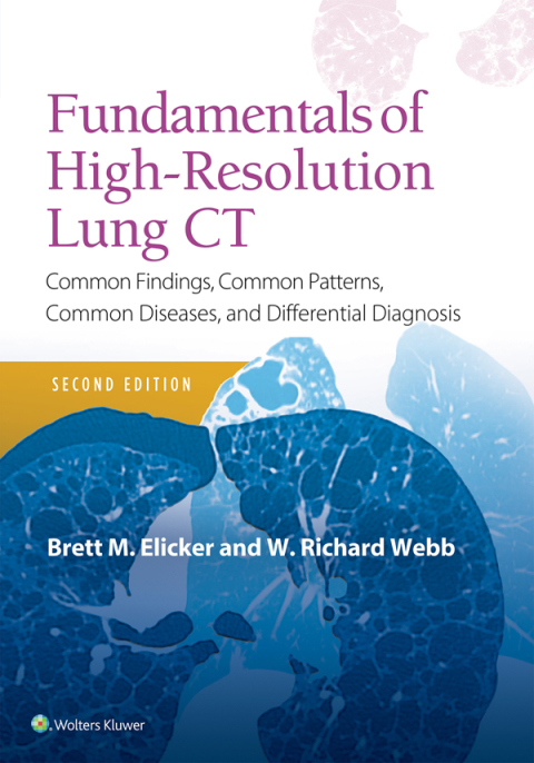 Fundamentals of High-Resolution Lung CT : Common Findings, Common Patterns, Common Diseases and Differential Diagnosis, 2nd Edition - FULL INSTANT DOWNLOAD | PDF DOCX EPUB