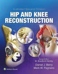 Cover image: Illustrated Tips and Tricks in Hip and Knee Reconstructive and Replacement Surgery 9781496392060