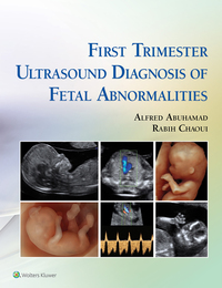Titelbild: First Trimester Ultrasound Diagnosis of Fetal Abnormalities 9781451193725