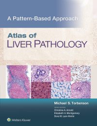 Omslagafbeelding: Atlas of Liver Pathology: A Pattern-Based Approach 9781496396976