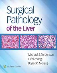 Cover image: Surgical Pathology of the Liver 9781496365798