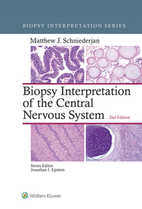 Titelbild: Biopsy Interpretation of the Central Nervous System 2nd edition 9781496382634