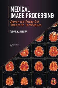 Cover image: Medical Image Processing 1st edition 9780367575960