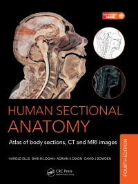 Omslagafbeelding: Human Sectional Anatomy 4th edition 9781498703604