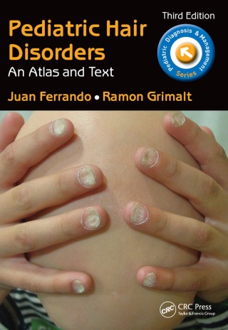 表紙画像: Pediatric Hair Disorders 3rd edition 9781498707770