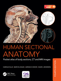 Omslagafbeelding: Human Sectional Anatomy 4th edition 9781498708548