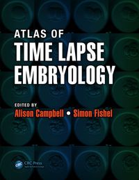 Titelbild: Atlas of Time Lapse Embryology 1st edition 9781482214468