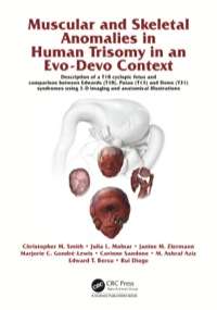 صورة الغلاف: Muscular and Skeletal Anomalies in Human Trisomy in an Evo-Devo Context 1st edition 9780367377793