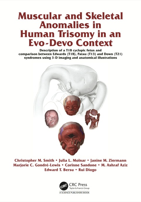 Muscular and Skeletal Anomalies in Human Trisomy in an Evo-Devo Context: Description of a T18 Cyclopic Fetus and Comparison Between Edwards (T18), Patau (T13) and Down (T21) Syndromes Using 3-D Imaging and Anatomical Illustrations, 1st Edition - FULL INSTANT DOWNLOAD | PDF DOCX EPUB