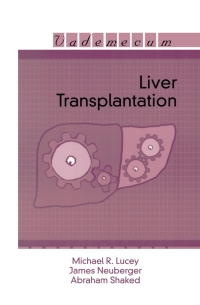 Imagen de portada: Liver Transplantation 1st edition 9781570596827