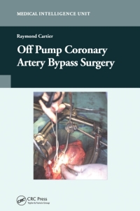 Imagen de portada: Off-Pump Coronary Artery Bypass Surgery 1st edition 9781587060755