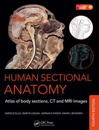 Cover image: Human Sectional Anatomy 4th edition 9781498703604