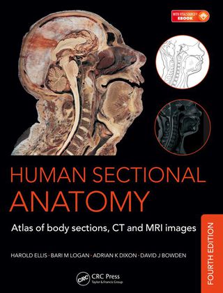 Cover image: Human Sectional Anatomy 4th edition 9781498703604