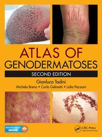 Immagine di copertina: Atlas of Genodermatoses 2nd edition 9781466598355