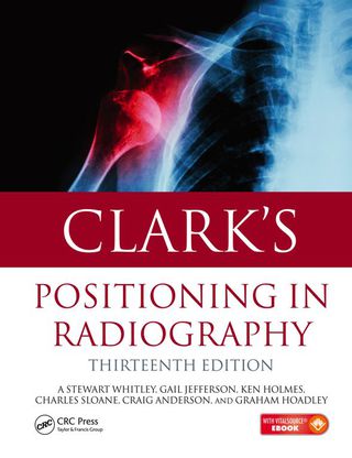 Cover image: Clark's Positioning in Radiography 13th edition 9781444122350