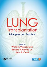 Titelbild: Lung Transplantation 1st edition 9781482233919