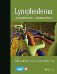 Cover image: Lymphedema 9781482241099