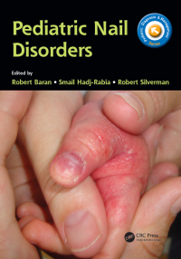 Cover image: Pediatric Nail Disorders 1st edition 9781138704343