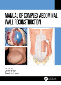 صورة الغلاف: Manual of Complex Abdominal Wall Reconstruction 1st edition 9780367485870