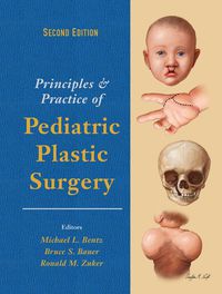 Cover image: Principles and Practice of Pediatric Plastic Surgery - Two Volume Set 2nd edition 9781482241372