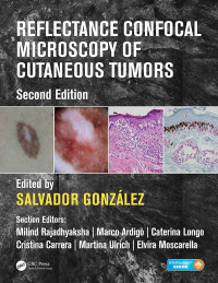 Cover image: Reflectance Confocal Microscopy of Cutaneous Tumors 2nd edition 9781498757607