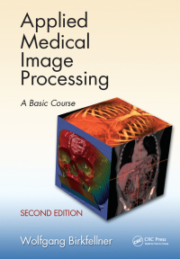 Immagine di copertina: Applied Medical Image Processing 2nd edition 9781466555570
