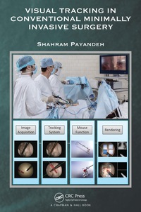 Cover image: Visual Tracking in Conventional Minimally Invasive Surgery 1st edition 9780367574307