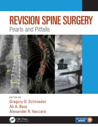 Titelbild: Revision Spine Surgery 1st edition 9781498773829
