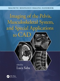 Omslagafbeelding: Imaging of the Pelvis, Musculoskeletal System, and Special Applications to CAD 1st edition 9780367868901