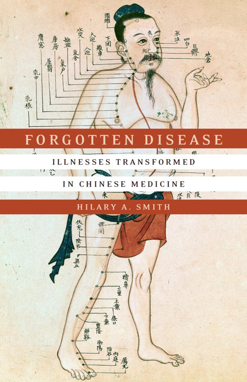 Forgotten Disease Illnesses Transformed in Chinese Medicine 1st Edition