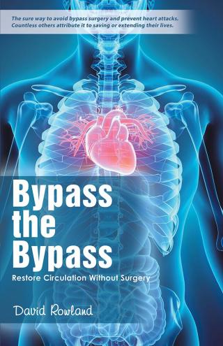 Omslagafbeelding: Bypass the Bypass 9781504362276