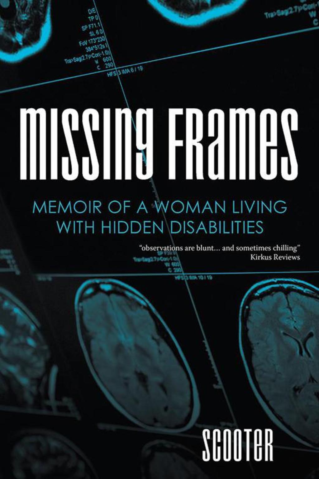 Missing Frames (eBook)