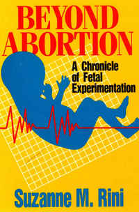 Cover image: Beyond Abortion 9780895554871