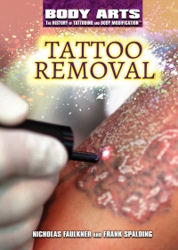 Imagen de portada: Tattoo Removal 9781508180791