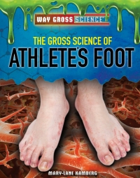 Cover image: The Gross Science of Athlete’s Foot 9781508181590