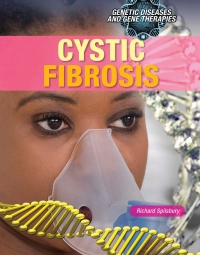 Imagen de portada: Cystic Fibrosis 9781508182726