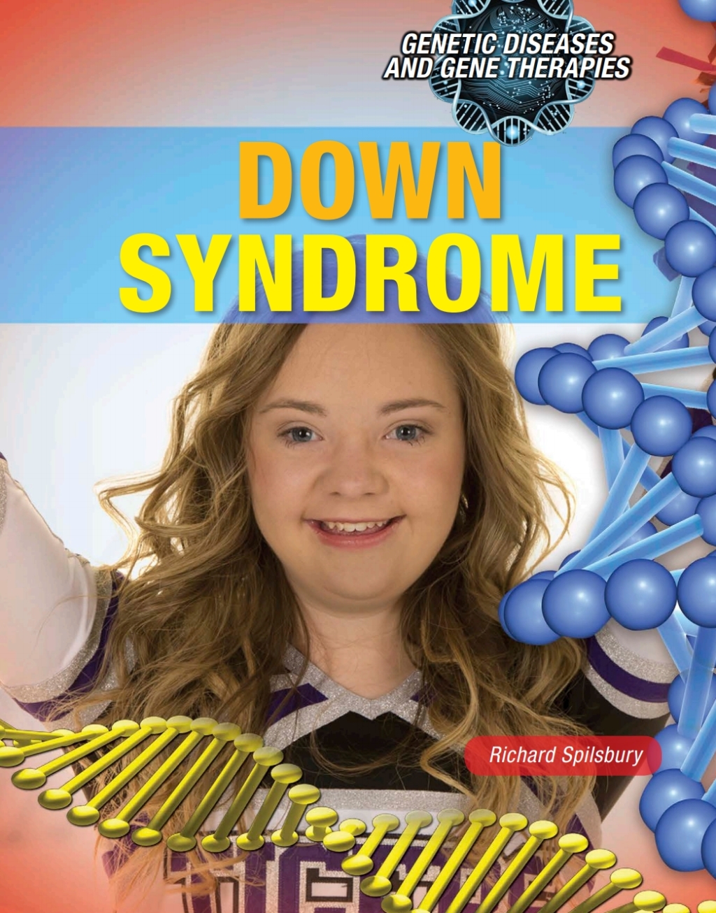 Down Syndrome