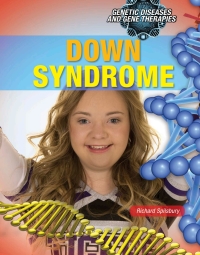 Cover image: Down Syndrome 9781508182801