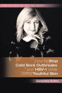 Imagen de portada: How to Stop Cold Sore Outbreaks and Hsv-1 While Getting Youthful Skin 9781524504427
