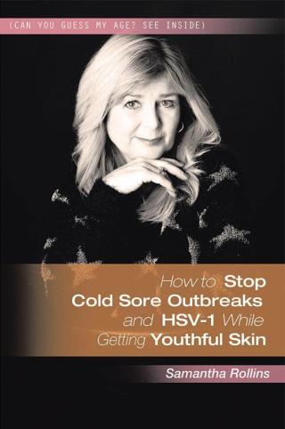 Cover image: How to Stop Cold Sore Outbreaks and Hsv-1 While Getting Youthful Skin 9781524504427