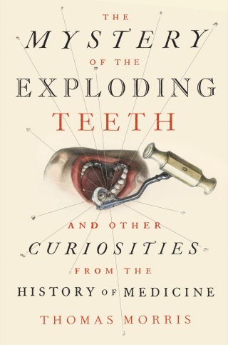 Cover image: The Mystery of the Exploding Teeth 9781524743680