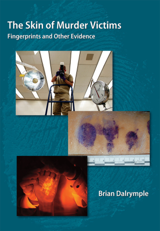 صورة الغلاف: The Skin of Murder Victims: Fingerprints and Other Evidence 1st edition 9781611630053