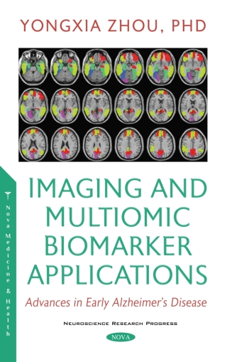 Imagen de portada: Imaging and Multiomic Biomarker Applications 9781536190793