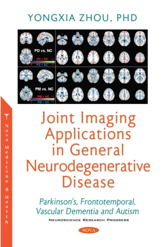 Cover image: Joint Imaging Applications in General Neurodegenerative Disease 9781536194357
