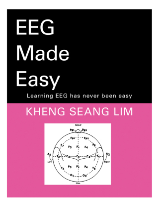 Cover image: Eeg Made Easy 9781543750218